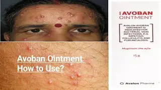 Avoban™ Ointment