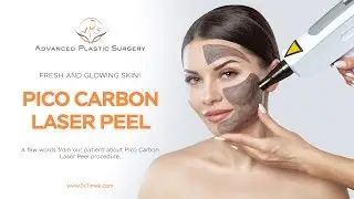 Pico Carbon Laser Peel