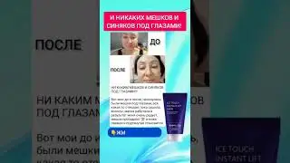 И никаких мешков и синяков под глазами!