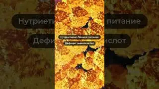 ПОЧЕМУ У ВАС ЖИРОВОЙ ГЕПАТОЗ? 