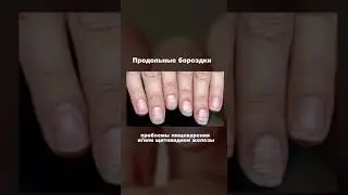 Посмотри на свои ногти