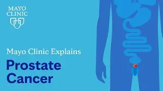 Mayo Clinic Explains Prostate Cancer