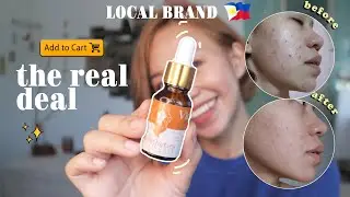 Kaesthetics vitamin C serum 2021 | @nikkimabida