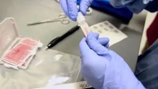 Cord Blood Transplant