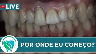 Interrelação Perio-prótese na resolução de casos estéticos