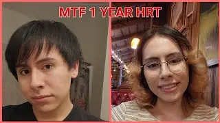 MTF Transition Timeline (1 Year)