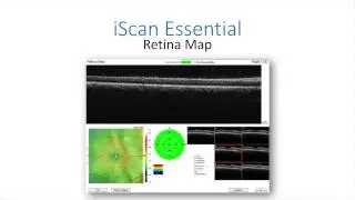 Optovue iScan Demo