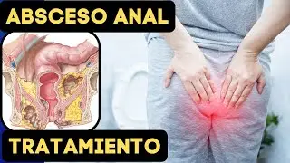 🧲 𝗔𝗕𝗦𝗖𝗘𝗦𝗢 𝗔𝗡𝗢𝗥𝗥𝗘𝗖𝗧𝗔𝗟 Causas, Síntomas y Tratamiento
