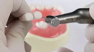 Pediatric Zirconia Crown Technique | Common Mistakes