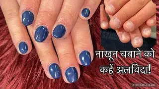 “Say Goodbye to Nail Biting! Stunning Gel Nail Transformation 💖” Step by Step 