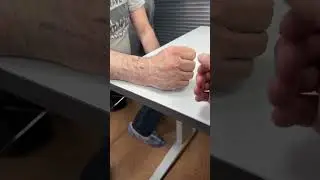 Hand Function 4 Weeks Post-Fracture | Radius Fracture