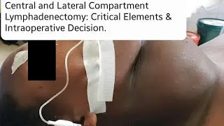 Central and Lateral Compartment Lymphadenectomy: Critical Elements & Intraoperative Decision. Part 4