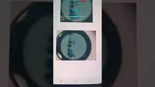 Mobile App Development for Raspberry Pi based Water Imaging Microscope | Water Scope | Bluetooth