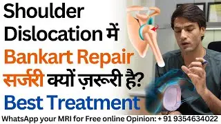 Shoulder Dislocation में सर्जरी क्यों ज़रूरी है? Best Treatment - Knotless Bankart Repair