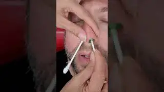RIP OUT MY NOSE HAIRS FROM THE ROOT! Nose Waxing 