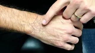 How I adjust the wrist 💥CHIROPRACTIC Secrets💥