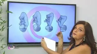 MIOMA E GRAVIDEZ