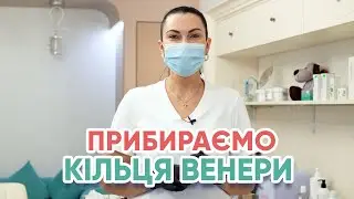 Прибираємо кільця ВЕНЕРИ! Juvederm Volite
