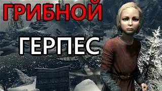 GAMER POOP - SKYRIM - ГРИБНОЙ ГЕРПЕС  [Русская озвучка]