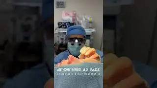 Discover Immediate Post-Rhinoplasty Result | Anthony Bared MD, FACS Miami, FL
