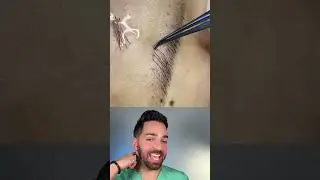 What on Earth Is This? Rare Find on Social Media| Doctorly Explains #shorts