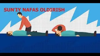 SUN'IY NAFAS OLDIRISH | СУНЪИЙ НАФАС ОЛДИРИШ.