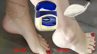 How to whiten hand & feet at home | Instant hand feet whitening |Face pack for glowing skin homemade
