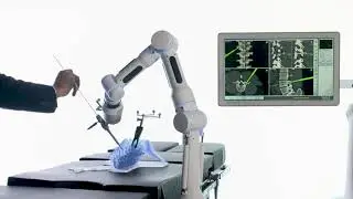 CIRQ System - How It Works