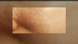 pores removal with baking soda