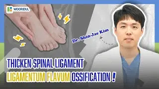 ligamentum flavum ossification?