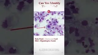 Can you identify these Cells In Body Fluid ? 🧐🙄🤔 #Quiz 406