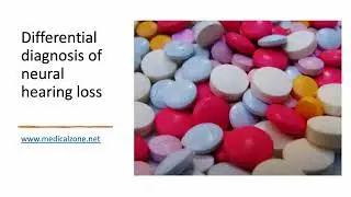 Medical Zone - Differential diagnosis of neural hearing loss