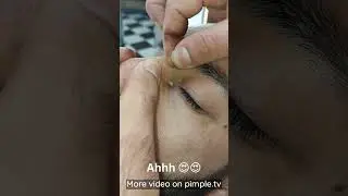 Ahhh 😍😍