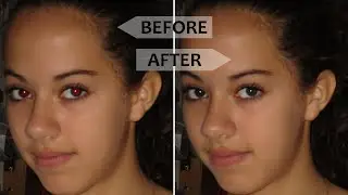 How to remove red eye from photo in photoshop ?