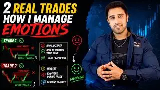 Not Every Trading Zone Is Valid! | 2 REAL Trades + Trading Psychology