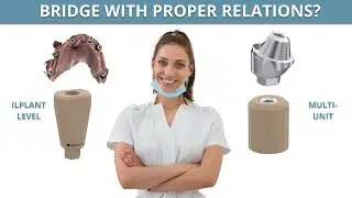 Prosthetics in dentistry | There were 4 dental implants, to which we added another 2 | All on four