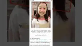 #mediapipe facemesh || #srinivasan000