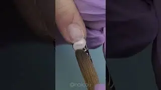 Dangerous Hangnail ⚠️ DON’T bite it off!