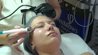 Ciltte Hydrafacial Tedavisi