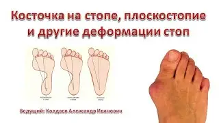 Про деформацию стоп