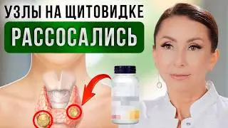 How to REDUCE THYROID NODES WITHOUT SURGERY? Thyroid Treatment