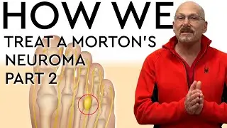 How We Treat A Morton's Neuroma Part 2