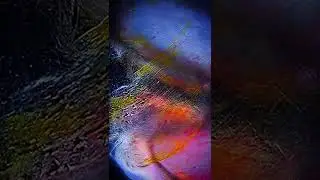 ВОТ КАК ВЫГЛЯДИТ ИНЖИР ПОД МИКРОСКОПОМ 🌰 