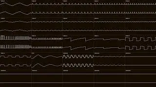 [Commander X16] Not as Expected (OSCILLOSCOPE VIEW; ORIGINAL)