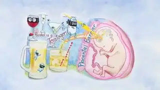 MODULE 1 Supporting Students with Fetal Alcohol Spectrum Disorders FASD
