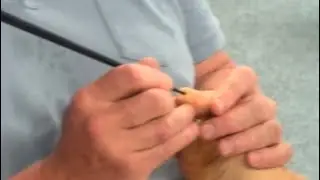 Reflexology foot massage using chopsticks to correct feet imbalances causing Scoliosis part 4