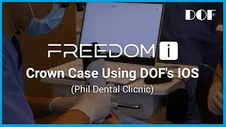 DOF | Crown Case Using DOF's IOS (Phil Dental Clicnic)