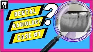 Dental radiology Case | Radiographic Interpretation | DENTAL CASE DISCUSSION