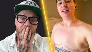 "You Don't Need Nipples"  Insane Transgender Surgery