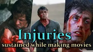 Sylvester Stallone - Injuries sustained while making movies